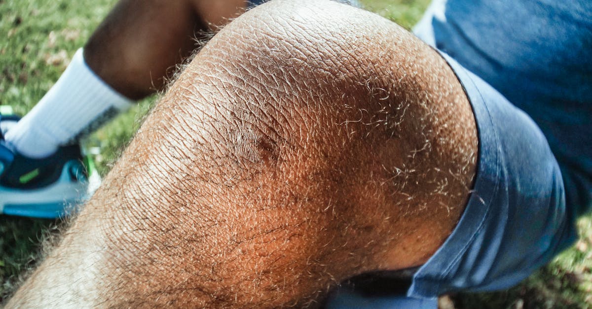 découvrez les causes, types et traitements des blessures sportives. apprenez comment prévenir les blessures pendant l’activité physique et favoriser une récupération rapide pour retourner au sport en toute sécurité.